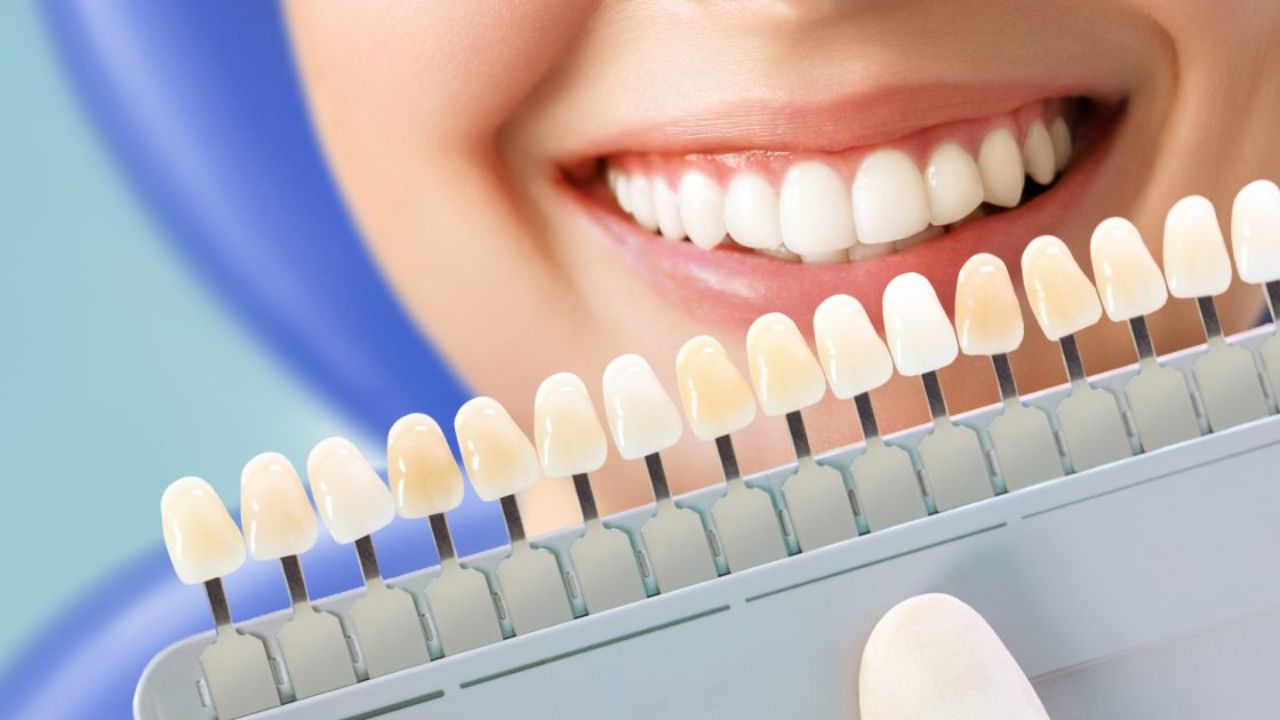 Take Your Whitening Lines to the Next Level with Customized UV Kits &amp; Gels